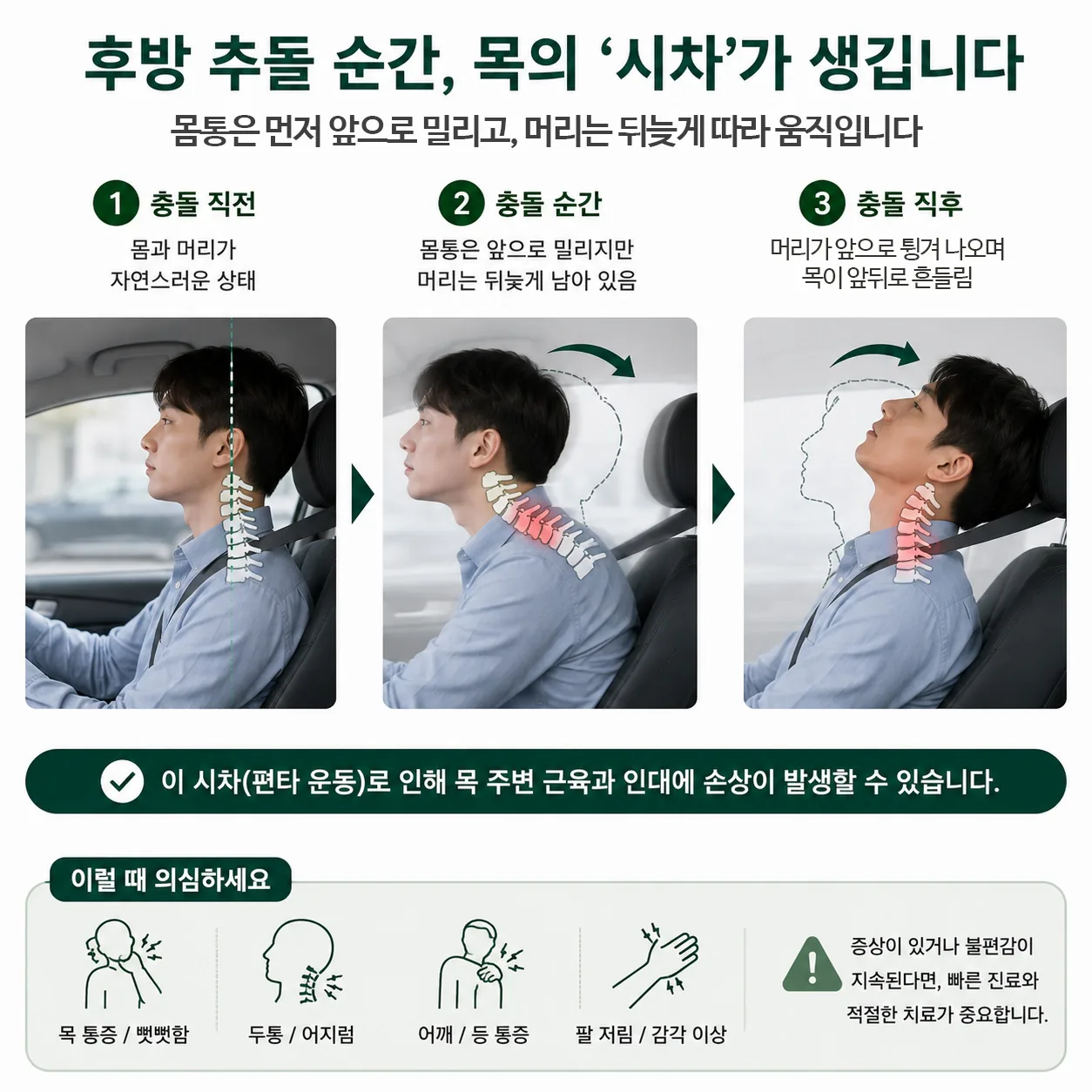 교통사고 후방 추돌에서 목이 앞뒤로 흔들리는 편타성 손상 모식도